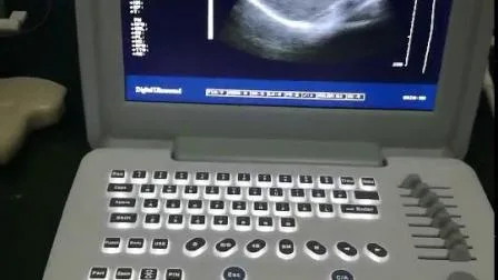 Scanner portatif numérique d'ultrason de l'hôpital B/W pour Gyn Gynecologic