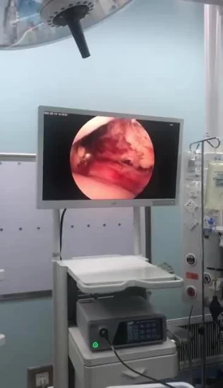 Instrument laparoscopique d'équipement médical d'endoscope laparoscopique
