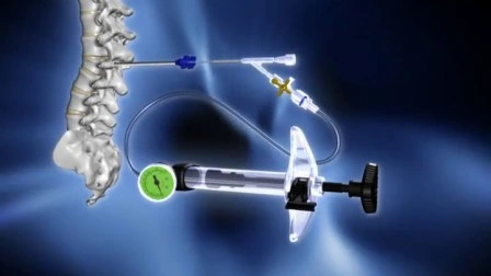 Instruments médicaux de chirurgie mini-invasive de la colonne vertébrale orthopédique Dragon Crown